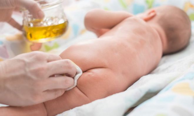 Опрелости у новорожденных: причины, признаки и способы лечения